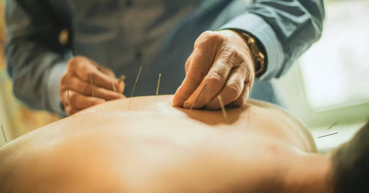 Benefits of Acupuncture for Veterans_ Chronic Pain Nervous System Regulation More
