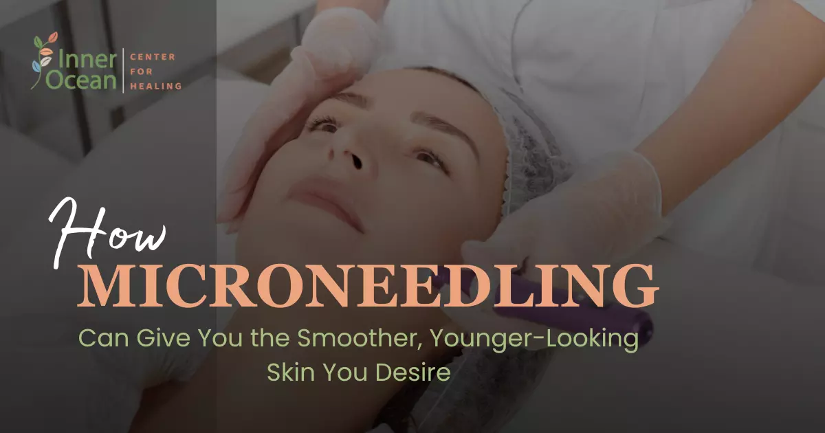 microneedling