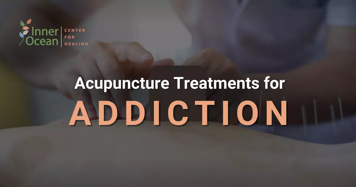 acupuncture treatments for addiction