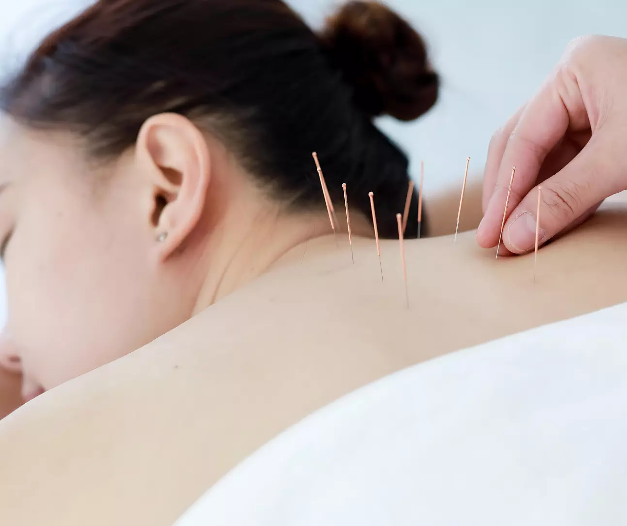 How Does Acupuncture Work