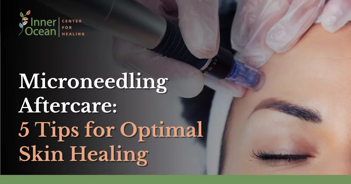 Microneedling Aftercare_ 5 Tips for Optimal Skin Healing
