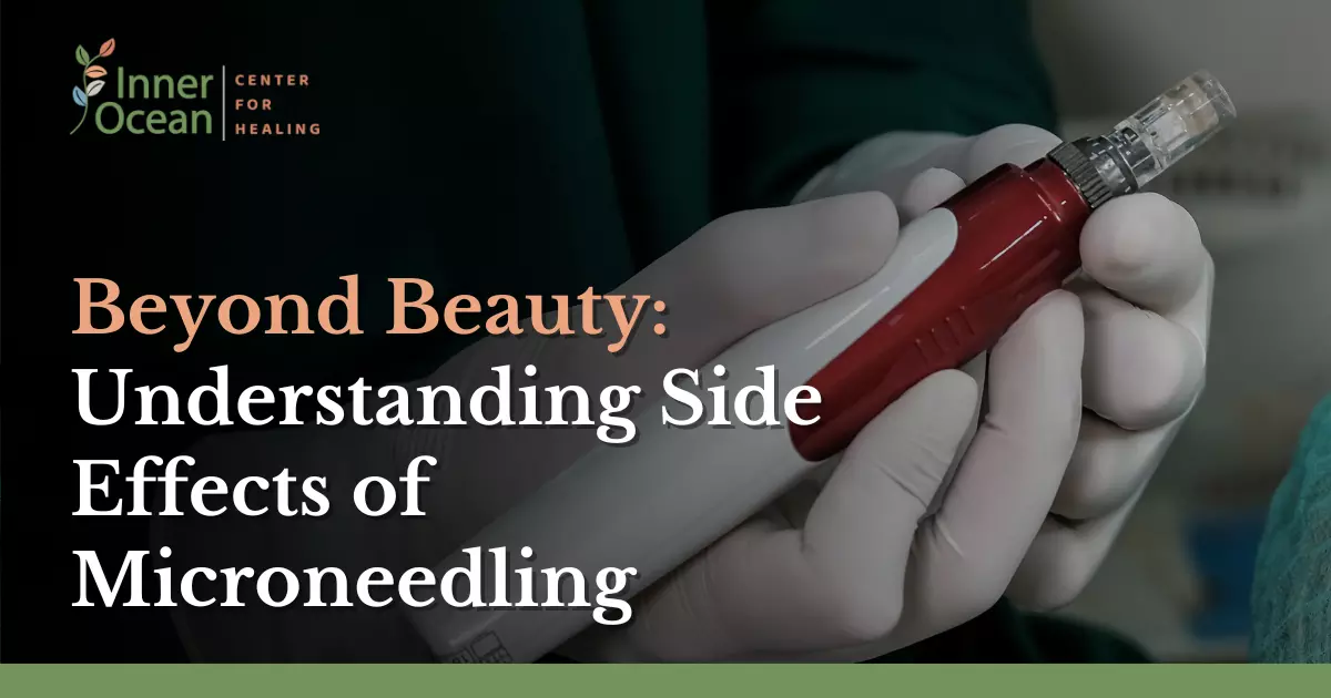 Beyond Beauty_ Understanding Side Effects of Microneedling