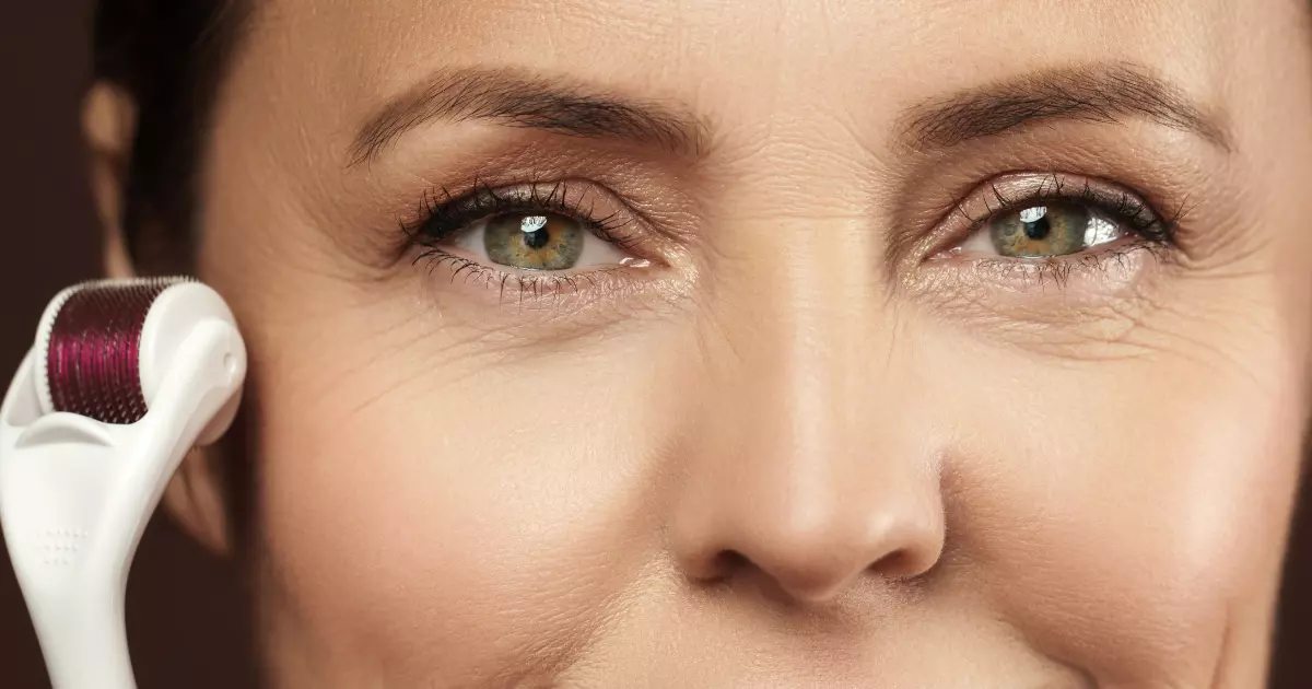 Does Microneedling Really Work for Wrinkles