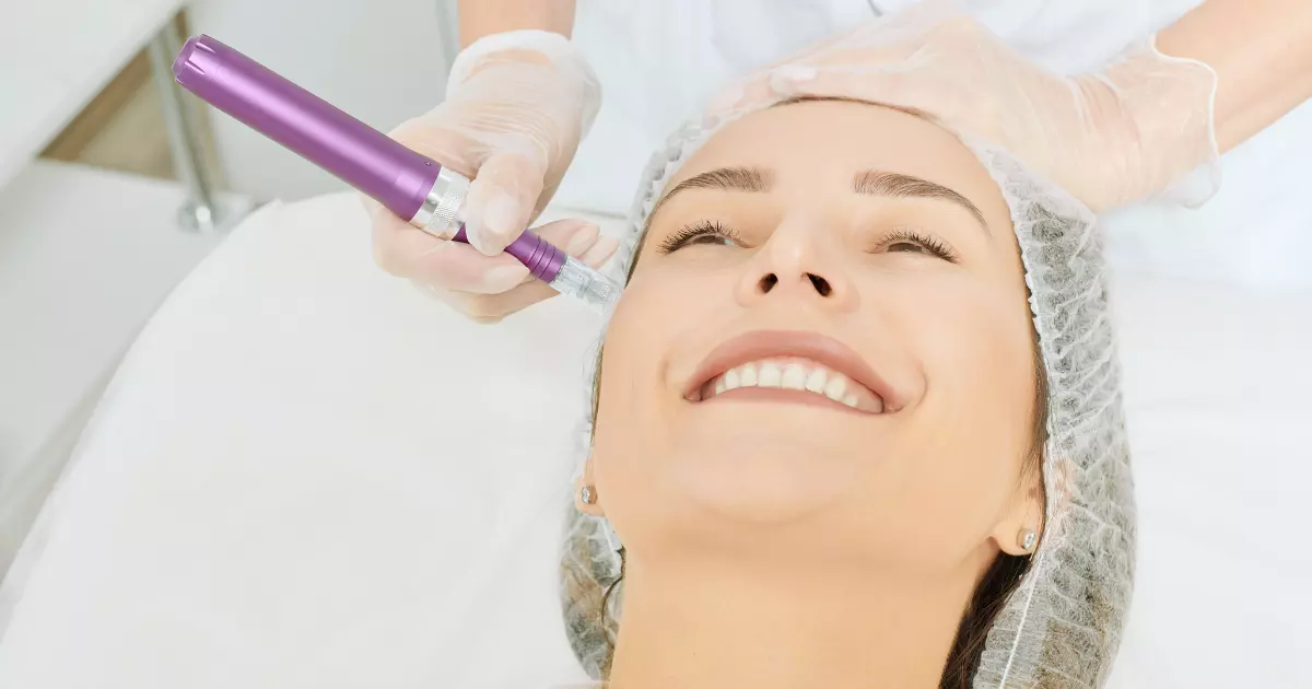 How Many Microneedling Sessions Do I Need to Get Rid of My Wrinkles