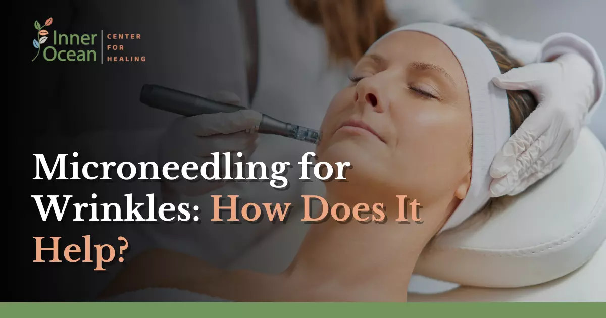Microneedling for Wrinkles_ How Does It Help