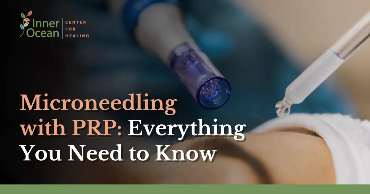 Microneedling with PRP_ Everything You Need to Know