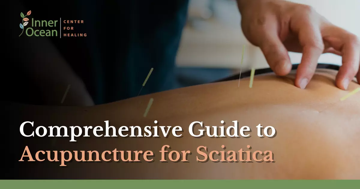 Comprehensive Guide to Acupuncture for Sciatica