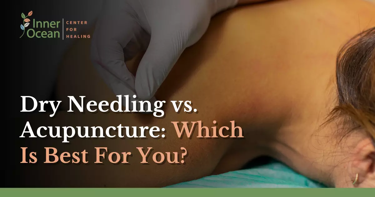 Dry Needling vs. Acupuncture Which Is Best For You