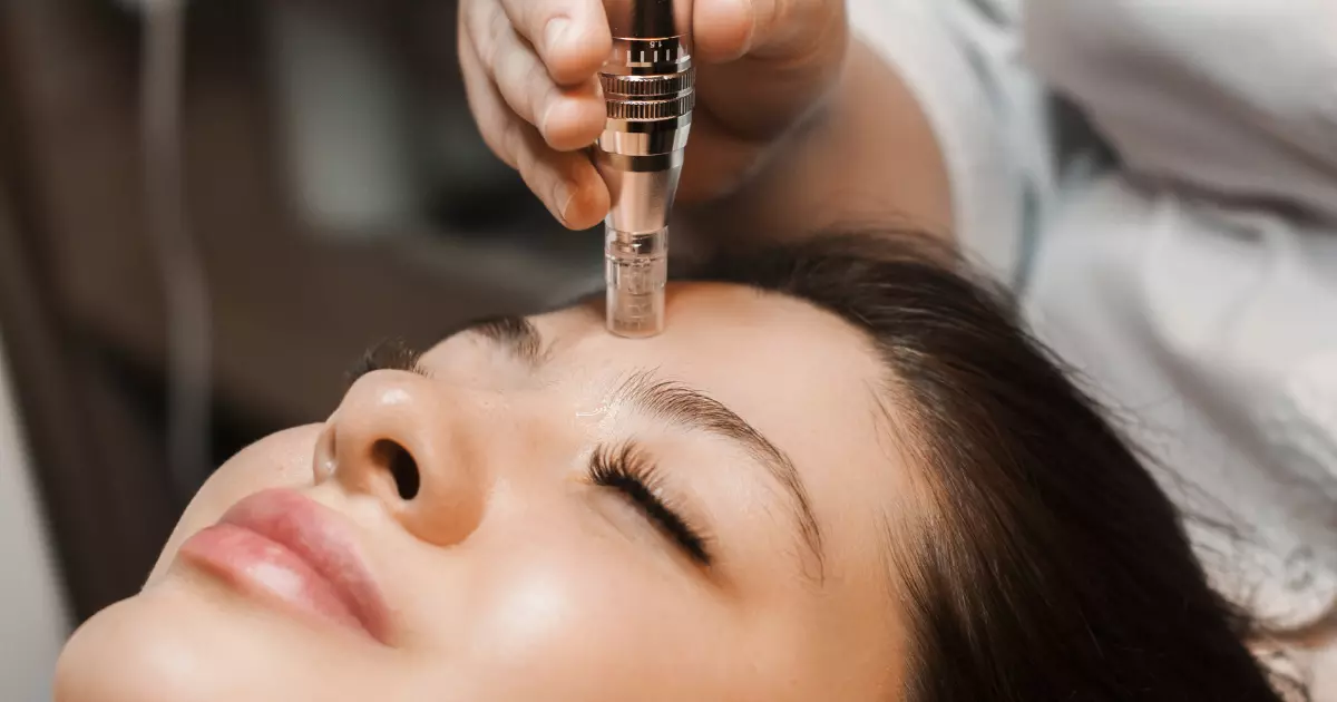 How Does Skin Pen Microneedling Work