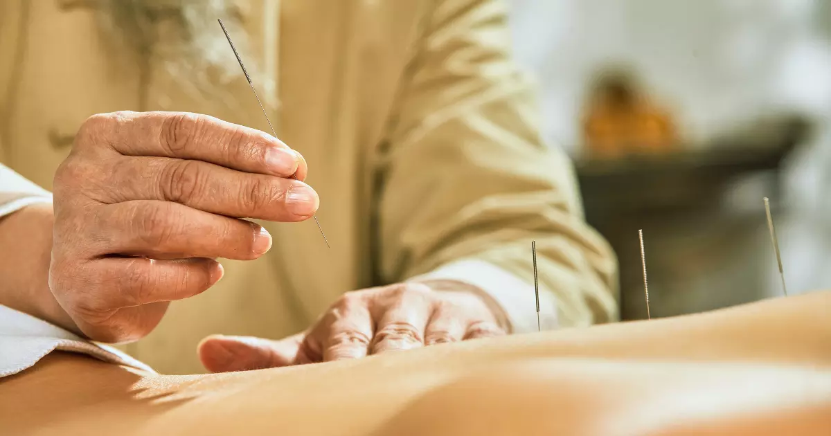 Traditional Chinese Medicine Acupuncture