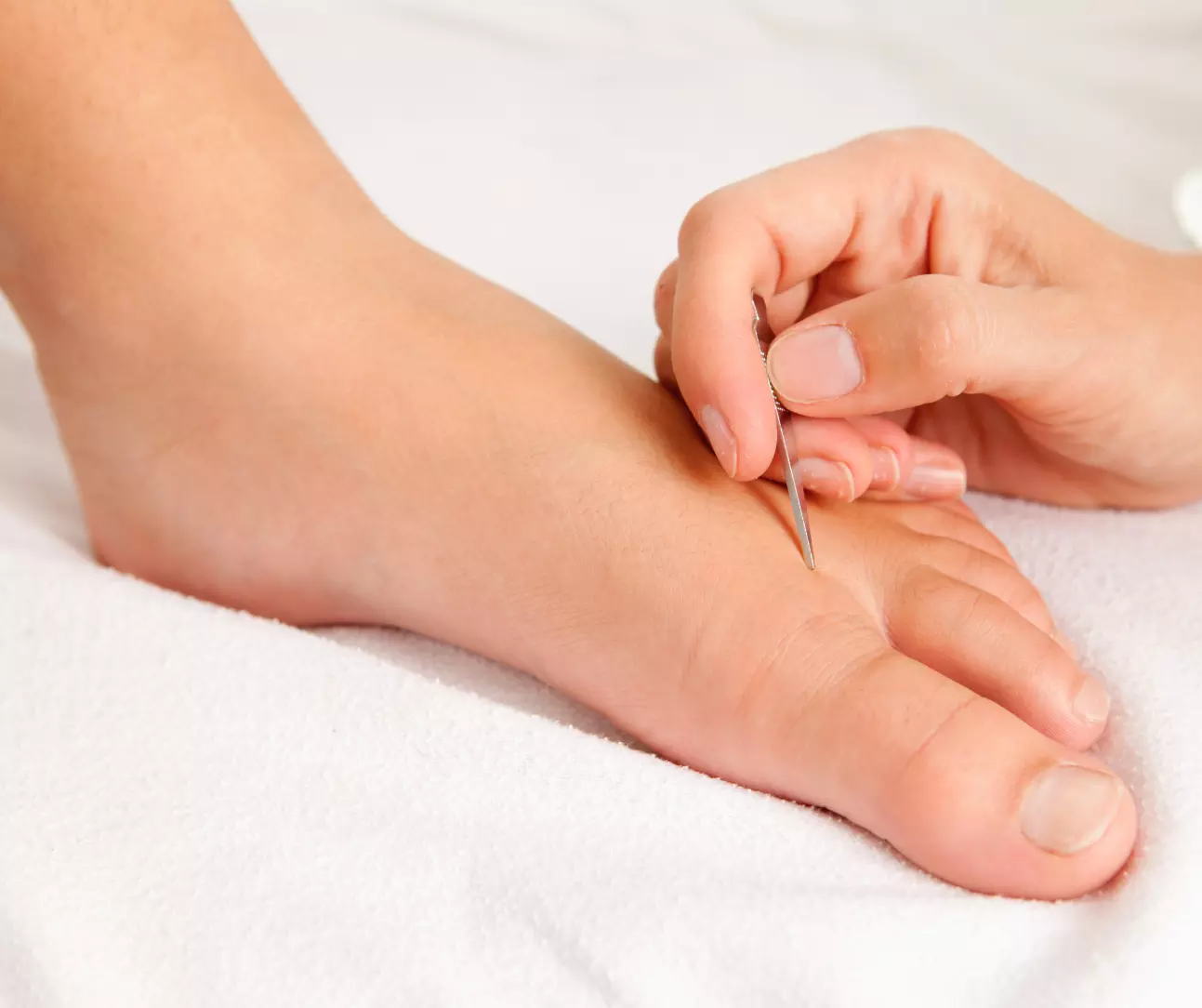 feet acupuncture