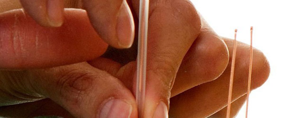 Accupuncture-service