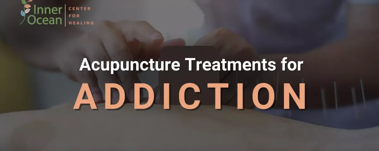 acupuncture treatments for addiction