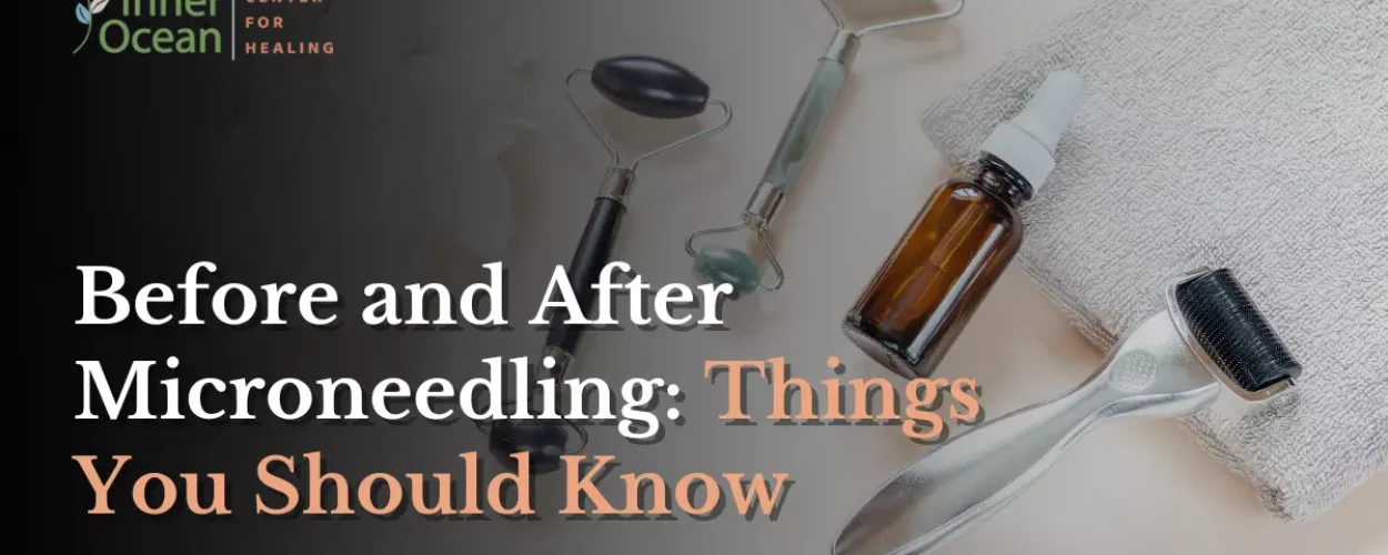 Before and After Microneedling_ Things You Should Know