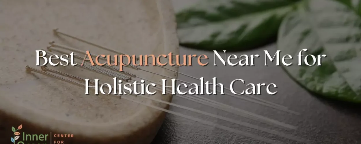 Best Acupuncture Near Me