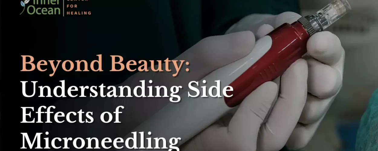 Beyond Beauty_ Understanding Side Effects of Microneedling