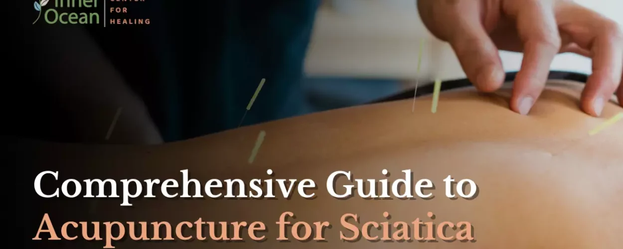 Comprehensive Guide to Acupuncture for Sciatica