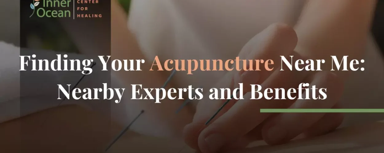 Finding Your Acupuncture Near Me_ Nearby Experts and Benefits