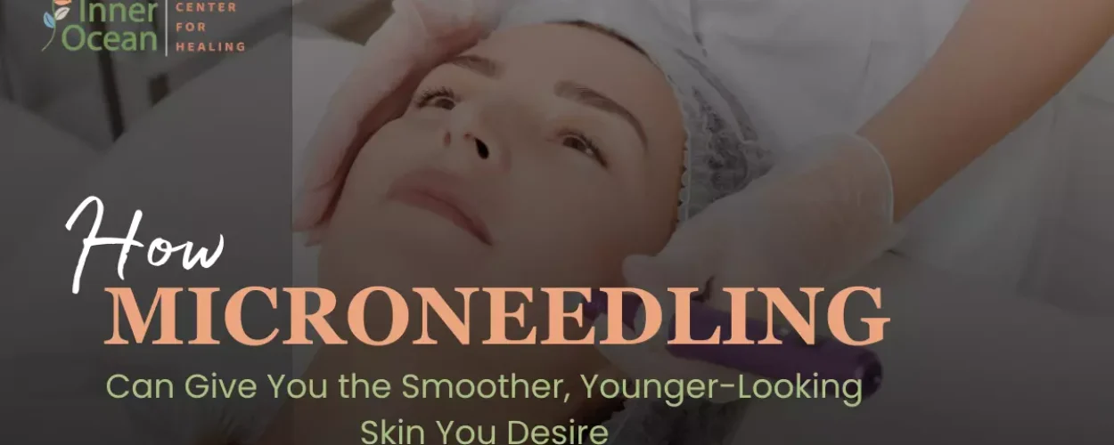 microneedling