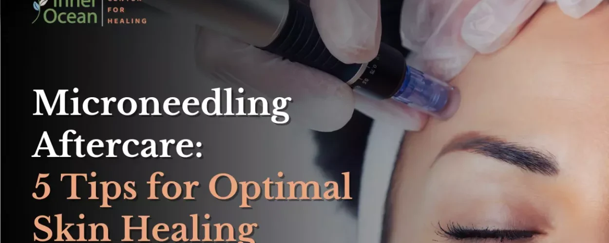 Microneedling Aftercare_ 5 Tips for Optimal Skin Healing