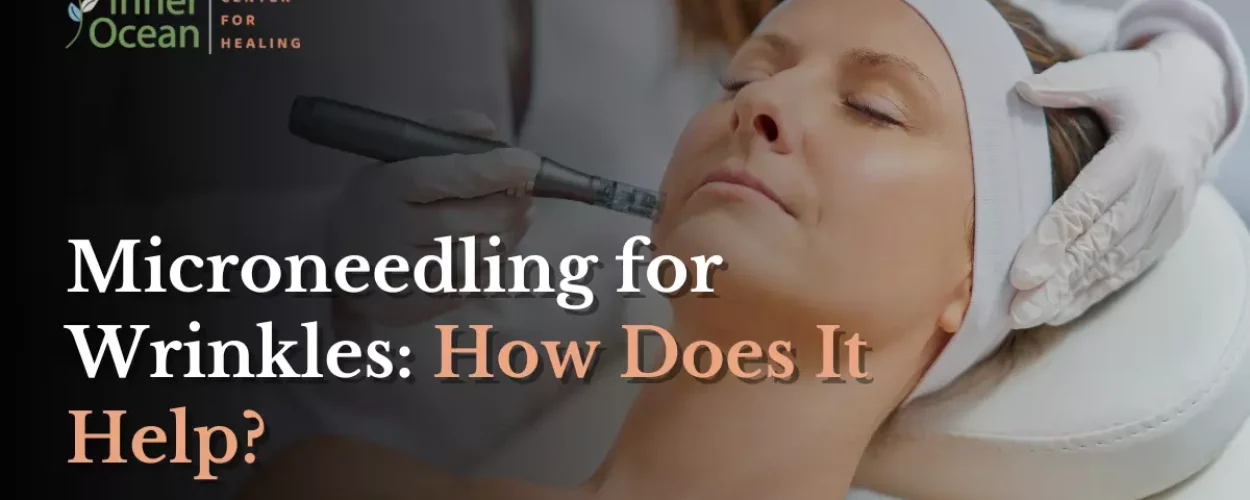 Microneedling for Wrinkles_ How Does It Help