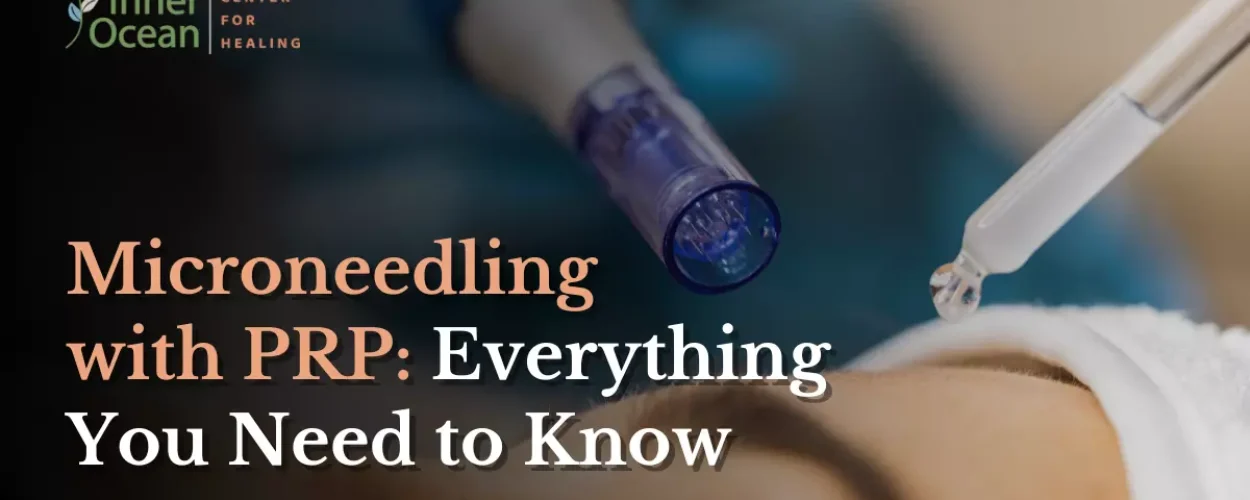 Microneedling with PRP_ Everything You Need to Know