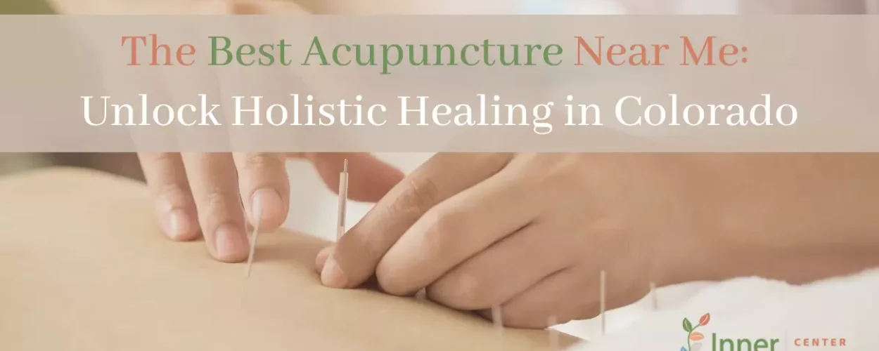 The Best Acupuncture Near Me_ Unlock Holistic Healing in Colorado